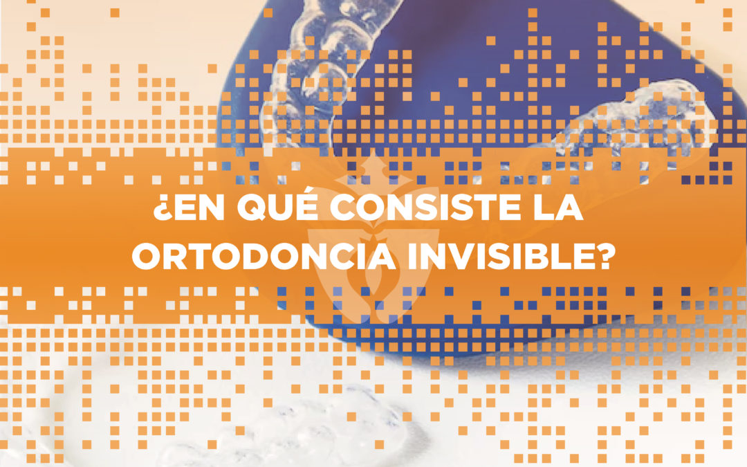 ¿En qué consiste la ortodoncia invisible?
